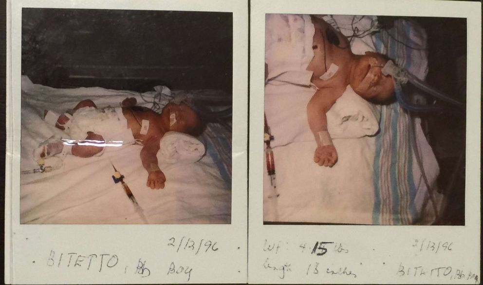 PHOTO: Joseph Bitetto was born at 28 weeks old in 1996. His father said he was in an incubator for more than a month.

