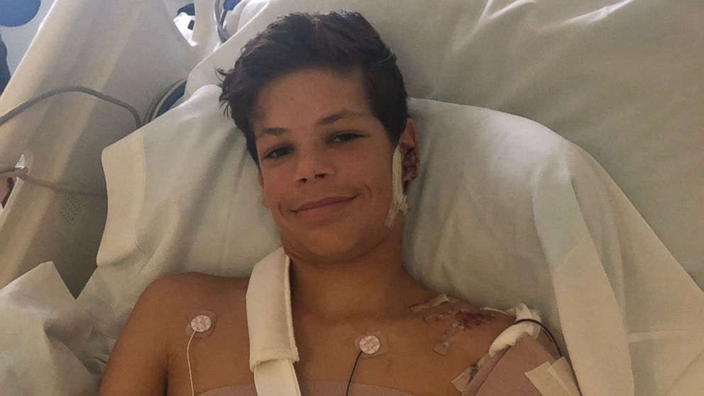 PHOTO: Keane Webre-Hayes, 13, is pictured in his hospital bed at Raby's Childrens Hospital in San Diego after surviving a shark attack on Sunday, Sept. 30, 2018.