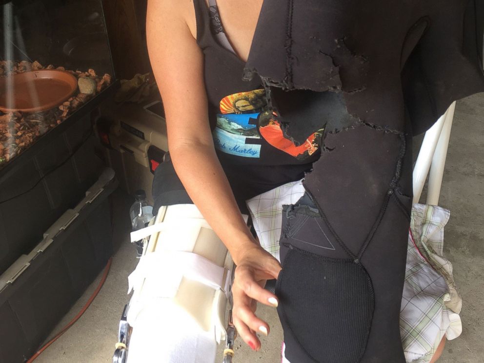 PHOTO: Leeanne Ericson was bitten by a shark earlier this year and opened up about the harrowing encounter in an exclusive interview with GMA.