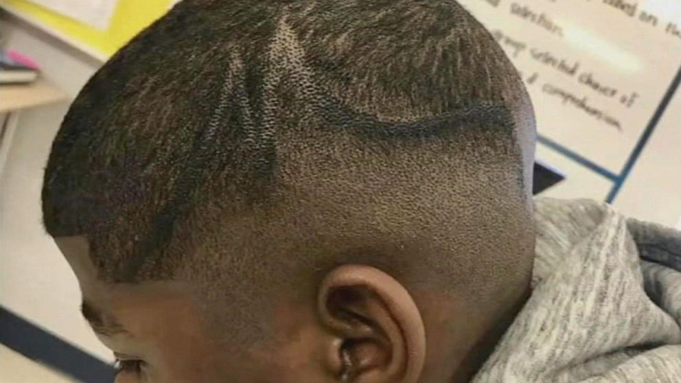 Texas family sues school, claiming staff laughed while coloring student's head with marker - ABC News Texas family sues school, claiming staff laughed while coloring student's head with marker - ABC News