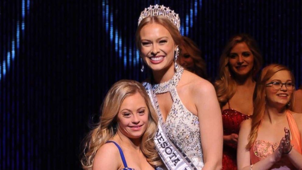 PHOTO: Nov, 26th 2017, Mikayla Holmgren, the first Miss USA state pageant competitor with Down syndrome, on the left, with the 2018 Miss Minnesota USA winner Kalie Wright, right. 