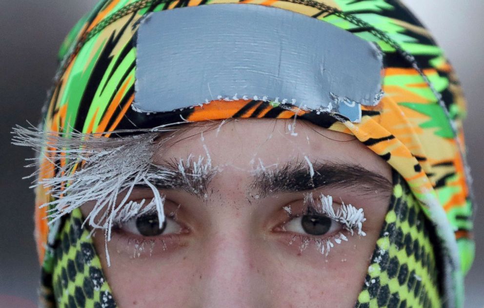 PHOTO: Frost covers part of the face of University of Minnesota student Daniel Dylla during a morning jog along Mississippi River Parkway, Jan. 29, 2019, in Minneapolis.