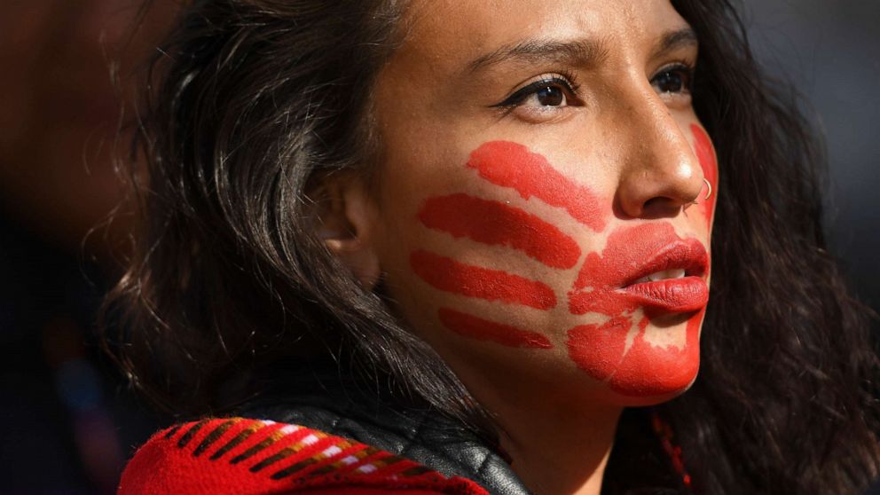 PHOTO: Micaela Iron Shell has painted red hands over their mouth to show solidarity for missing and murdered indigenous, black and migrant women and children during a rally in Denver, Oct. 11, 2019.