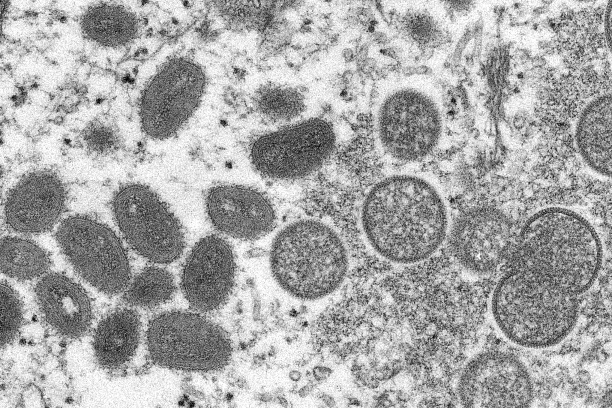 PHOTO: This 2003 electron microscope image made available by the Centers for Disease Control and Prevention shows mature, oval-shaped monkeypox virions, left, and spherical immature virions, right. 