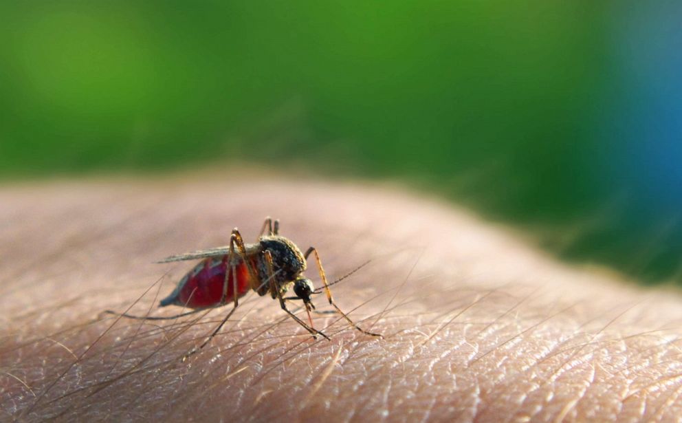 PHOTO: A mosquito lands on a persons skin in this undated stock photo. 