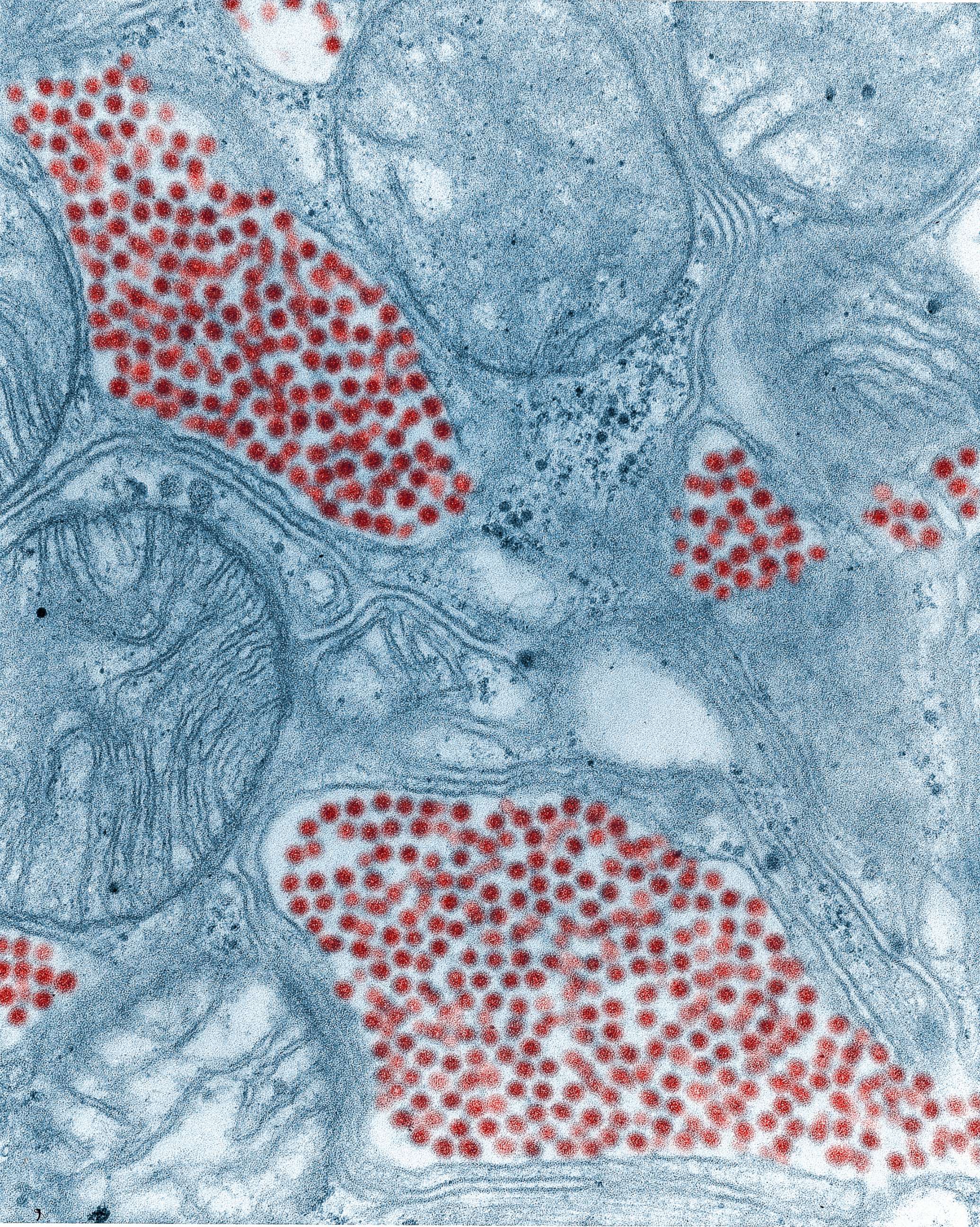 PHOTO: The Eastern equine encephalitis virus infecting the salivary gland of a mosquito has been colored red in this electron microscope image from 1968.
