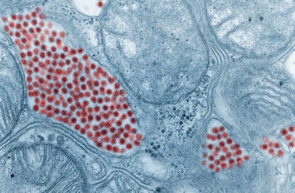 PHOTO: Eastern equine encephalitis virus infecting the salivary gland of a mosquito was stained in red on this electron microscope image from 1968.