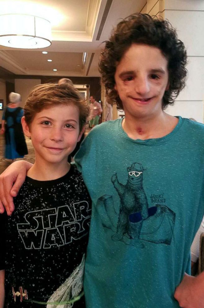 PHOTO: Nathaniel Newman is pictured with actor Jacob Tremblay, who portrays a kid born with Treacher Collins syndrome in the film, "Wonder."