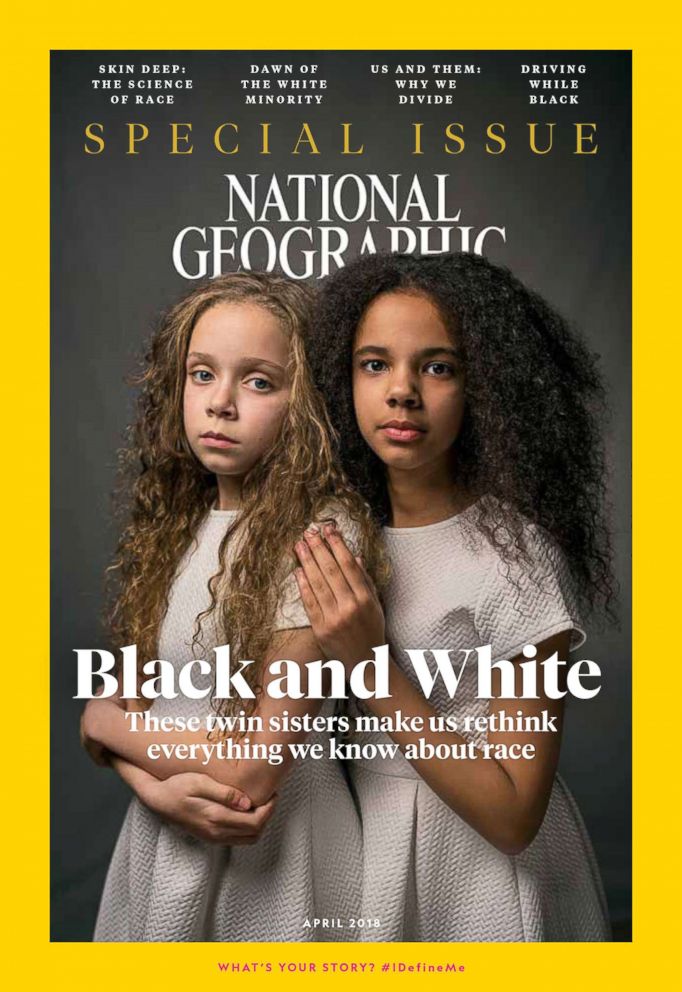  Marcia and Millie Briggs, 11-year-old biracial twins, are featured on the cover of the April issue of National Geographic magazine, a single topic issue on the subject of race.