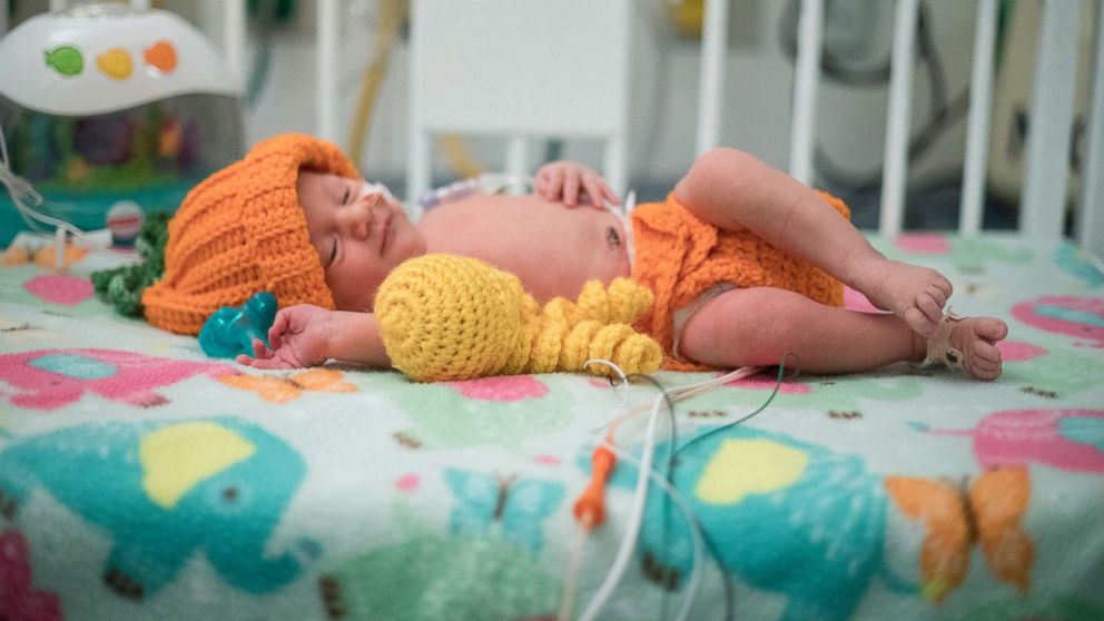 PHOTO: One of the NICU patients, Angela, is dressed up in one of Fankhauser's knitted costumes as a pumpkin.