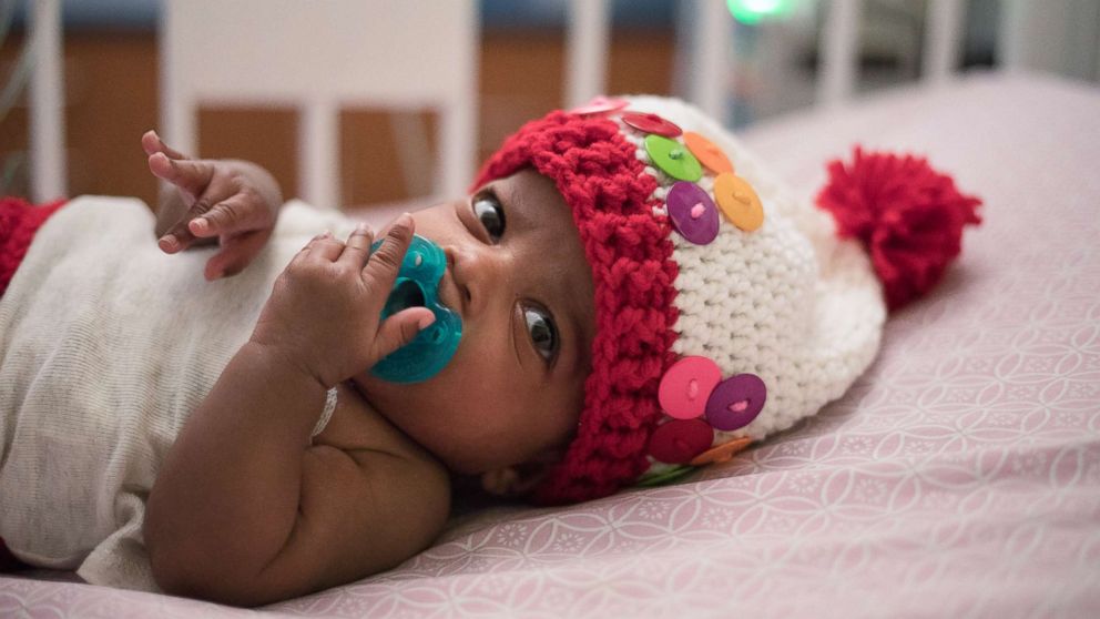 PHOTO: Children's Healthcare of Atlanta's NICU nurse Tara Fankhauser knit costumes for patients like Charleigh, who dressed as a gumball machine.