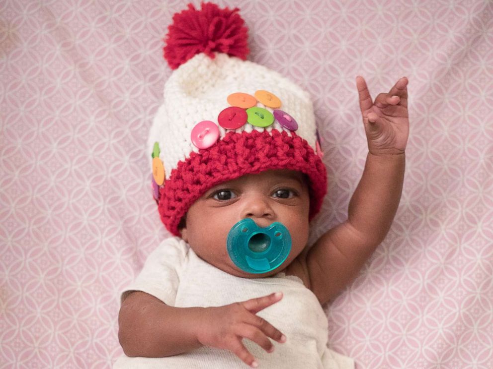 PHOTO: Tara Fankhauser, who is a nurse at Childrens Healthcare of Atlantas NICU, knits costumes for patients like Charleigh, who dressed as a gumball machine.