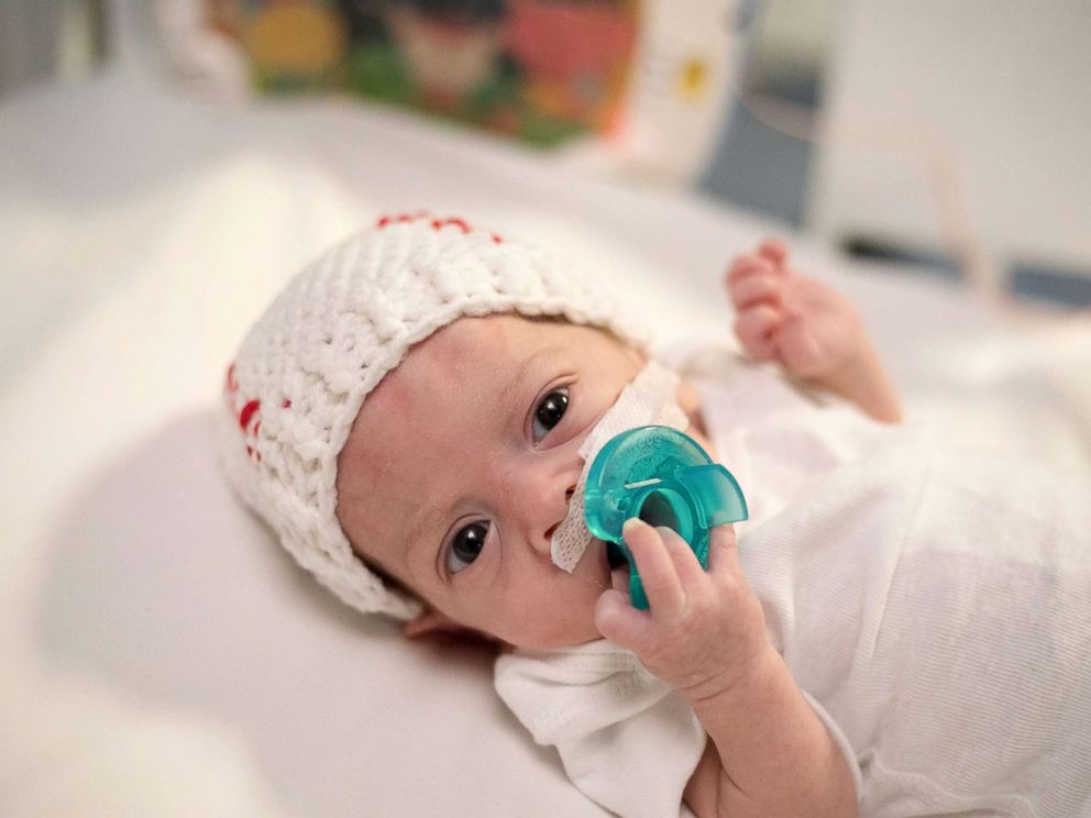 PHOTO: Giovanni, one of CHOAs NICU babies, is ready for Halloween, fitted in a hat knit as a baseball and cute blue shorts.