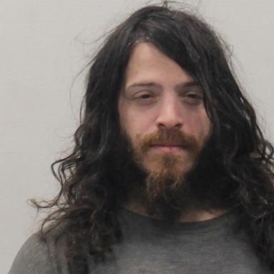 Nikolas Rescigno, 31, has been charged with assault and battery with a dangerous weapon with serious bodily injury.