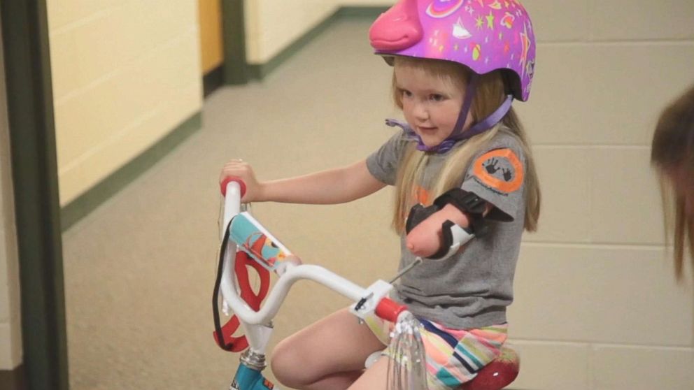 PHOTO: Drew Gill, 4, was born without part of her arm. 