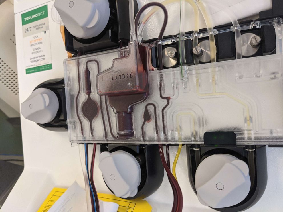 PHOTO: An automated blood collection machine used for blood plasma donation.