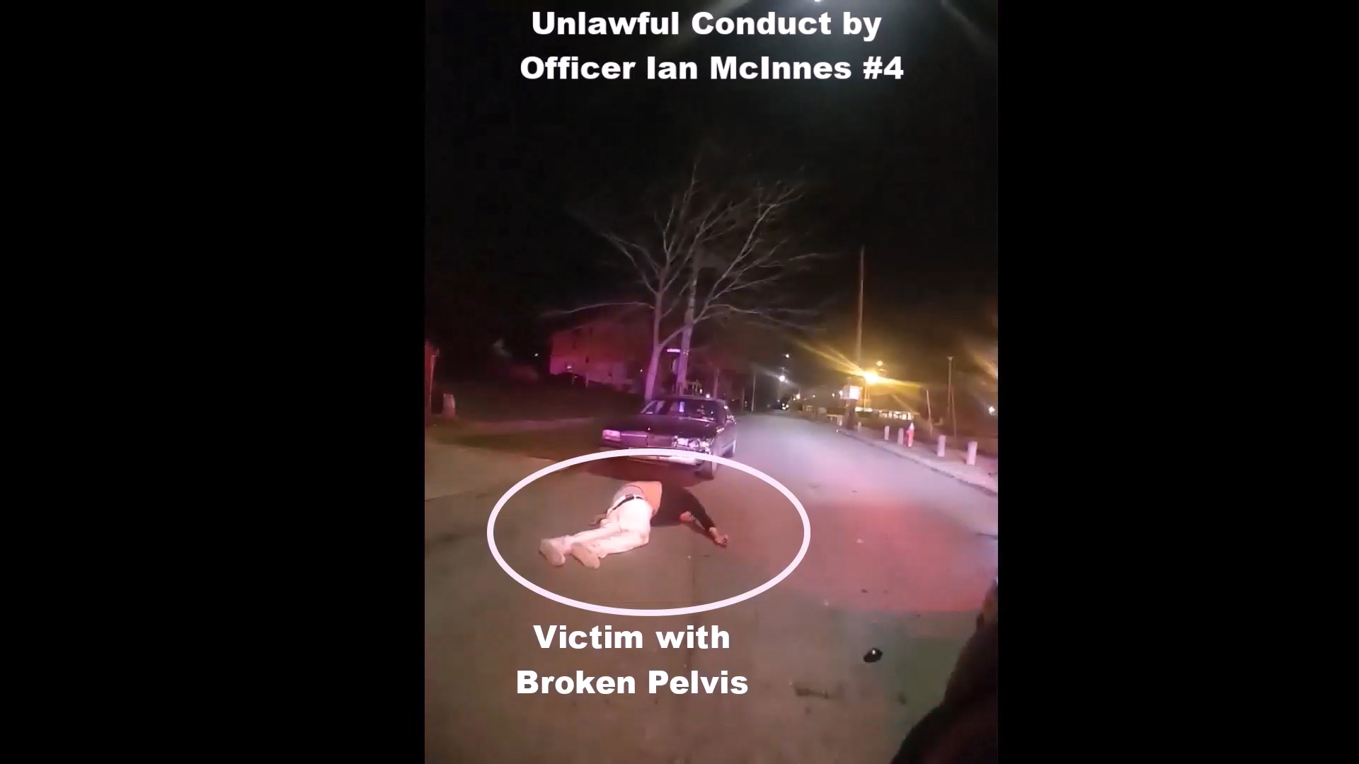 PHOTO: An image from East Cleveland police body cam footage shows a suspect laying on the ground with a broken pelvis after being struck by a police vehicle, released as part of their investigation into police misconduct.