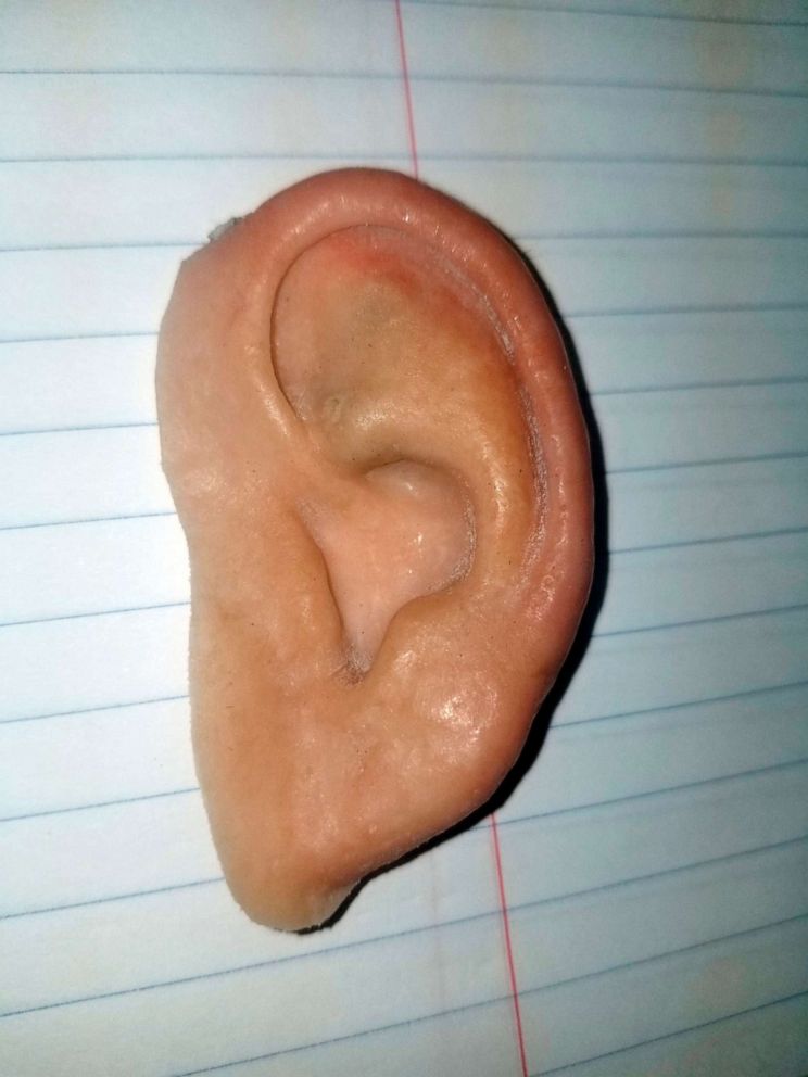 PHOTO: In this photo made available by the City of Holmes Beach Police Department, a prosthetic ear is displayed on June 20, 2019. The ear was found in the sand after the "World's Strongest Man" contest on June 15, 2019.
