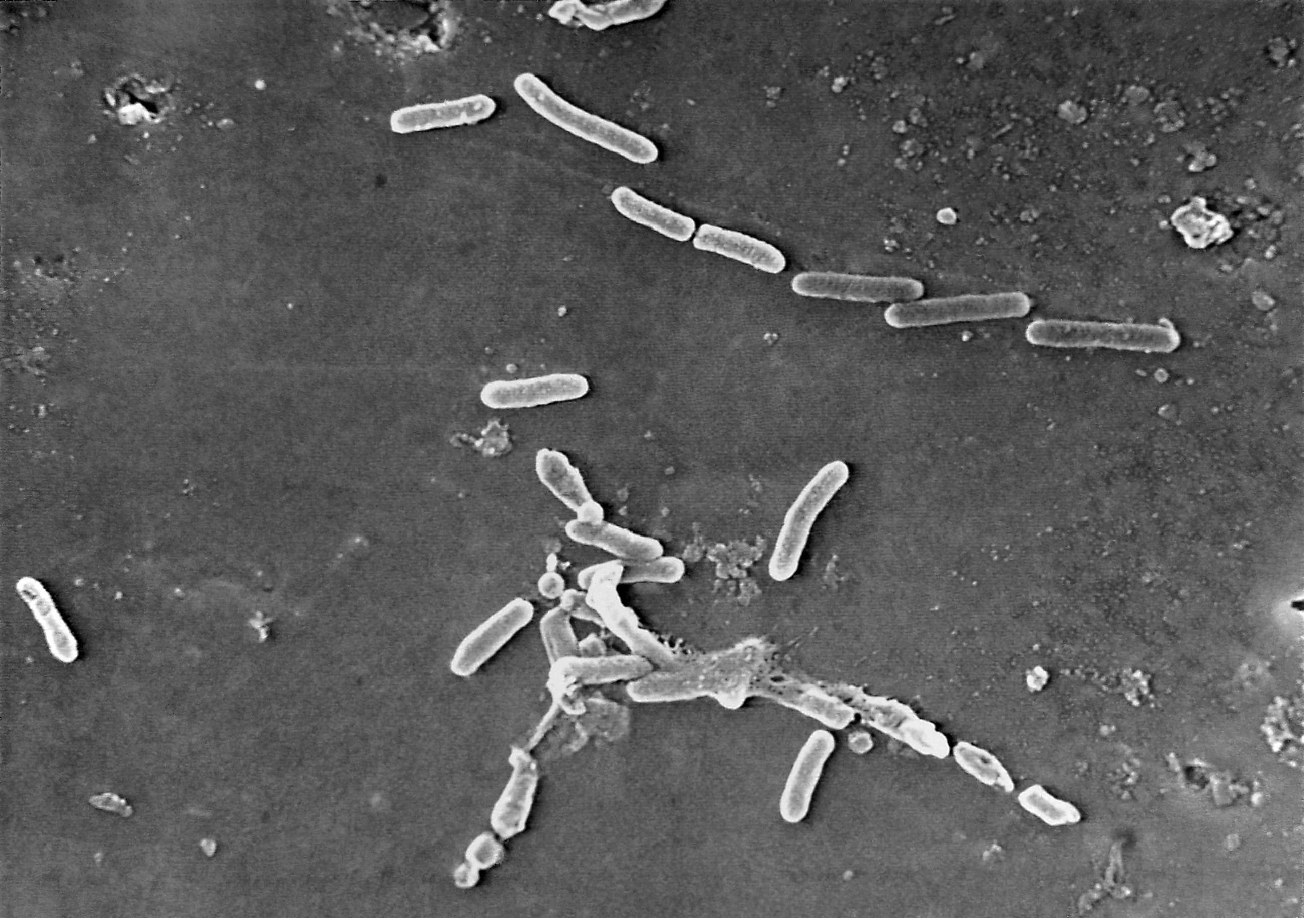 PHOTO: This scanning electron microscope image made available by the Centers for Disease Control and Prevention shows rod-shaped Pseudomonas aeruginosa bacteria.