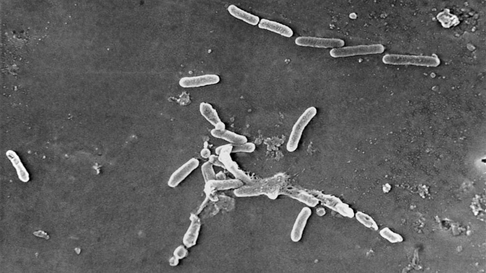 PHOTO: This scanning electron microscope image made available by the Centers for Disease Control and Prevention shows rod-shaped Pseudomonas aeruginosa bacteria.