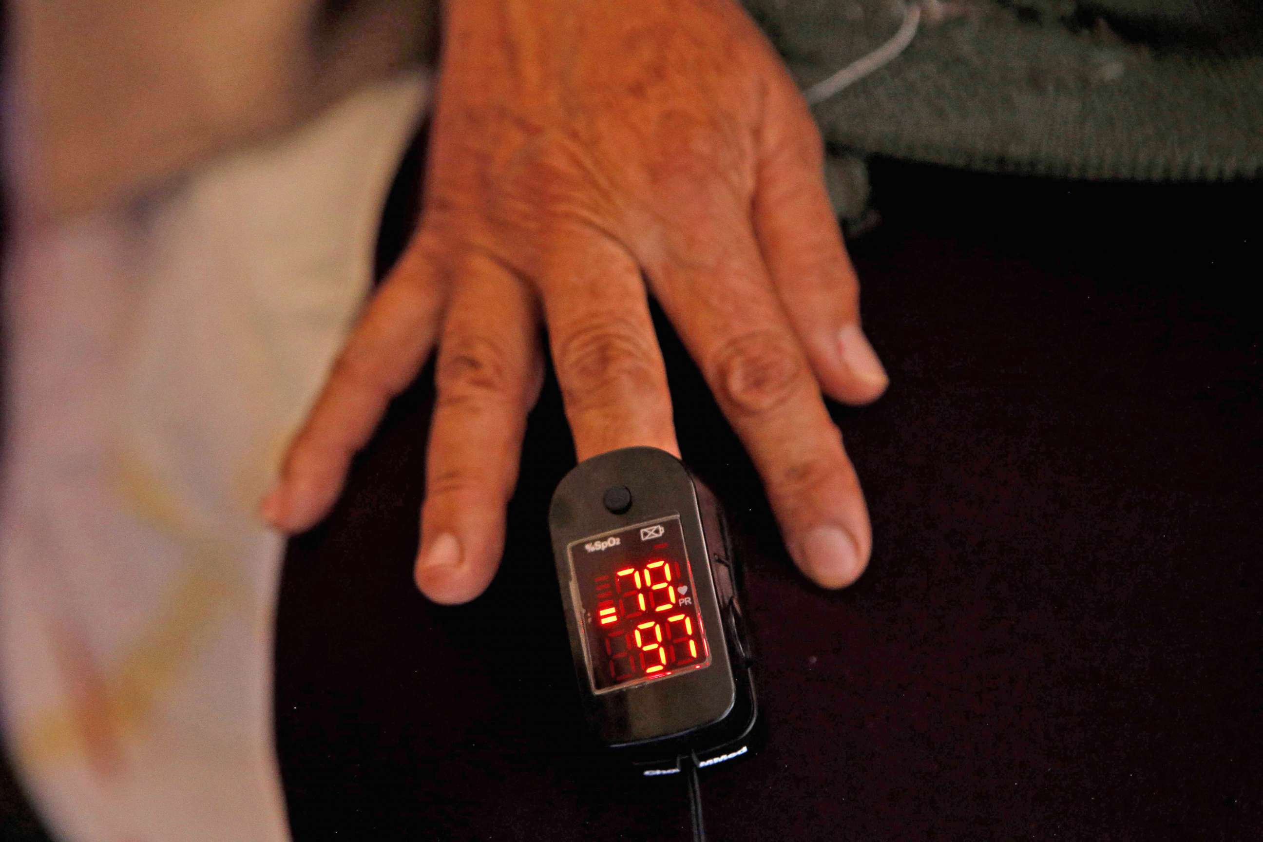 PHOTO: A coronavirus patient gets her oxygen level measured with a pulse oxymeter at her house in Jalisco, Mexico, Feb. 18, 2021.