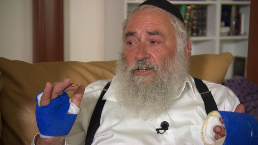 PHOTO: Rabbi Yisroel Goldstein speaks with ABC News after he was shot at the Chabad in Poway Synagogue outside of San Diego, Calif., April 28, 2019.