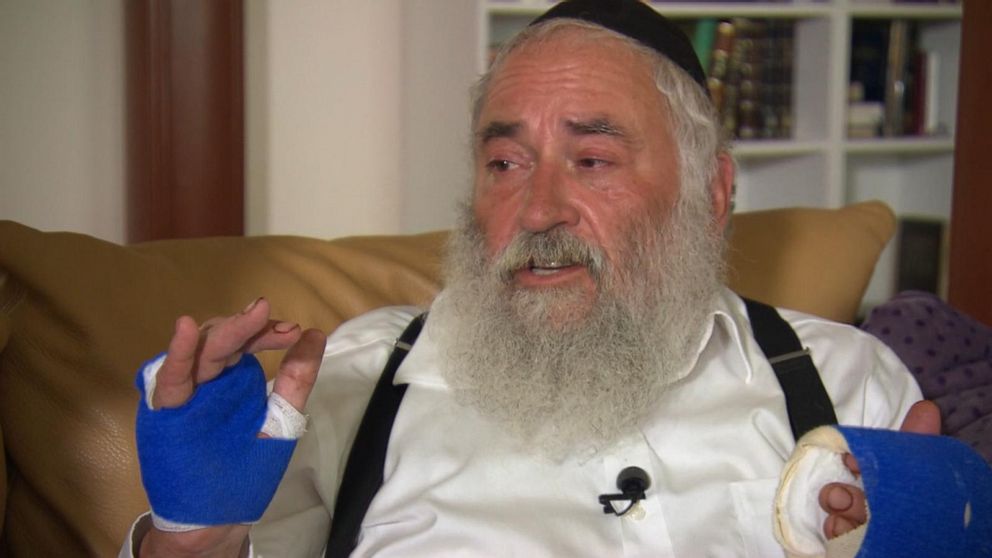 PHOTO: Rabbi Yisroel Goldstein speaks with ABC News after he was shot at the Chabad in Poway Synagogue outside of San Diego, Calif., April 28, 2019.