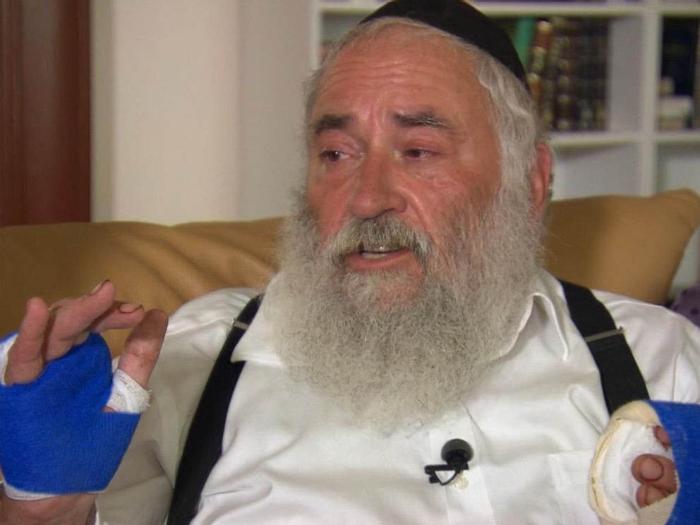 PHOTO: Rabbi Yisroel Goldstein speaks with ABC News after being shot in Chabad Synagogue, Poway, outside San Diego, California on April 28, 2019.