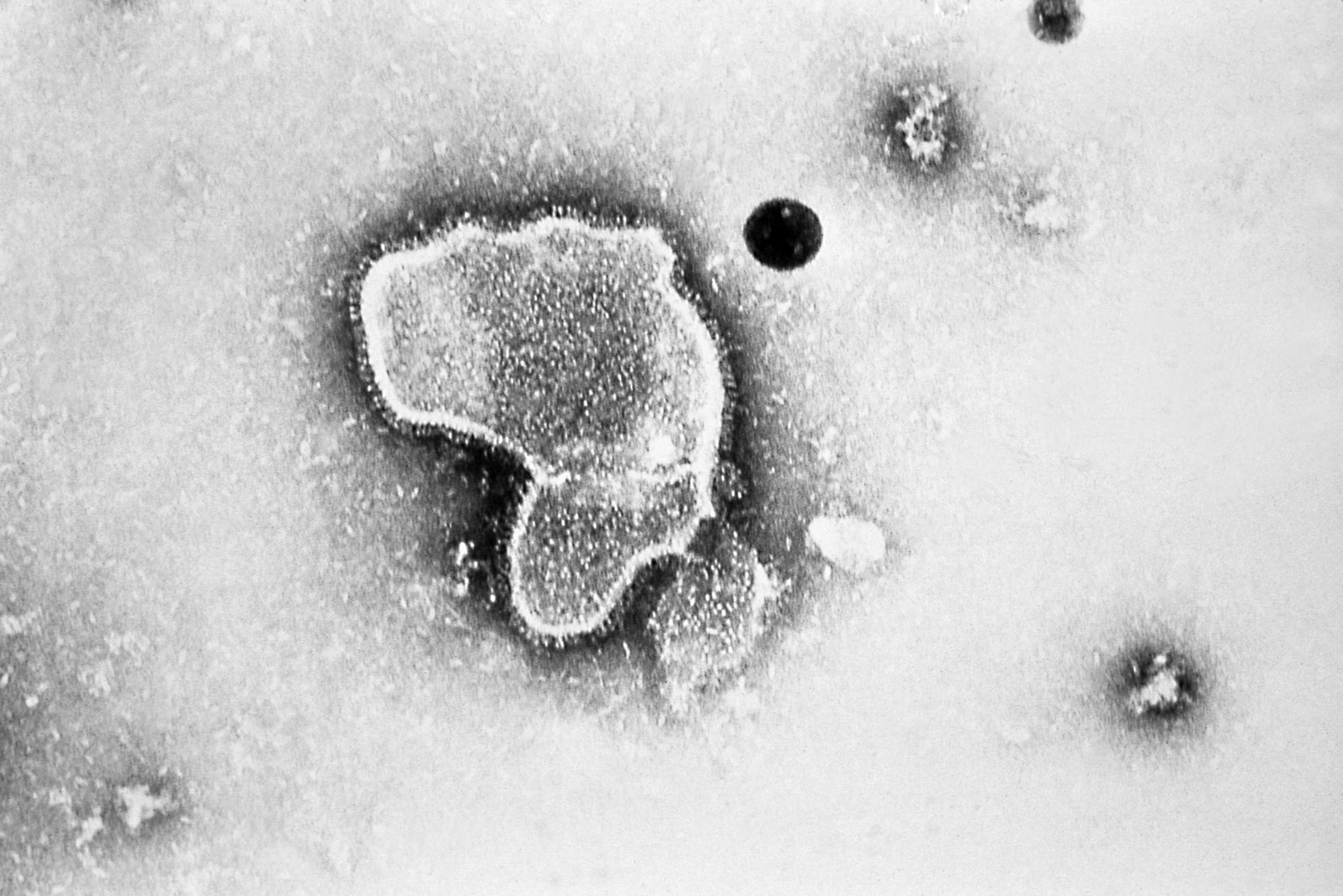 PHOTO: An electron micrograph of Respiratory Syncytial Virus, also known as RSV. 