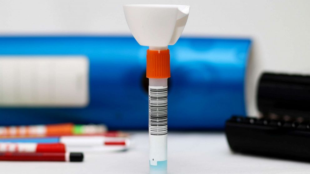PHOTO: A saliva test to detect the coronavirus is pictured in an image on March 9, 2021. 