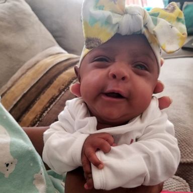 She was the world's smallest baby. Now she's a healthy infant