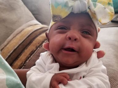 World S Smallest Surviving Baby Born At 5 Pounds Goes Home 5 Months After Birth Abc News