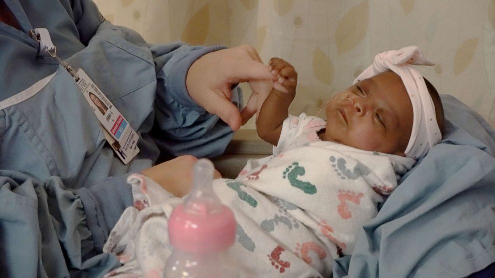 World S Smallest Surviving Baby Born At 5 Pounds Goes Home 5 Months After Birth Abc News