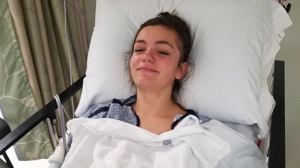 PHOTO: Megan Pagnini, 13, was attacked by a sea lion on Friday, June 14, 2019, and suffered a deep gash to her leg.