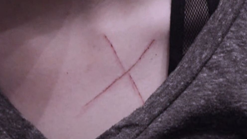 PHOTO: CJ Precopia was also accused of carving an "X" onto the chest of his ex-girlfriend during the alleged attack, his lawyer, Rick Flores, told ABC News. 