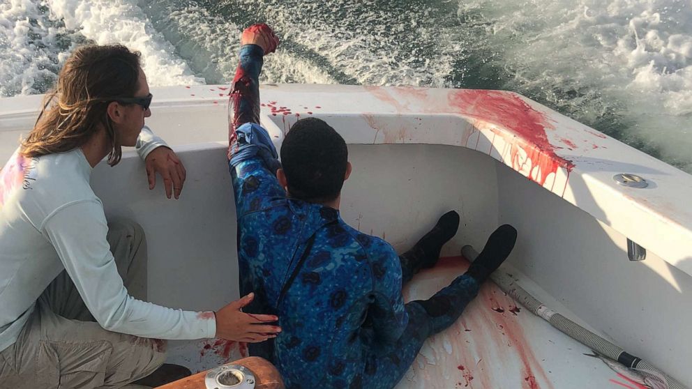 VIDEO: Nurses tend to shark attack victim who crawled on their boat near Miami