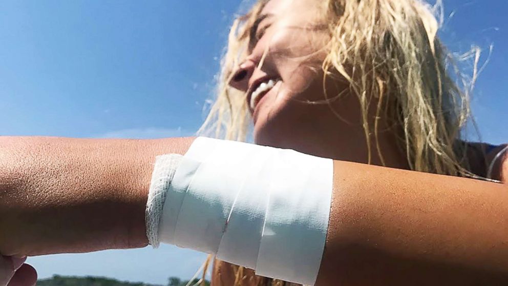 PHOTO: Katarina Zarutskie was bitten by a shark in the Bahamas, in an attack that her boyfriend’s father caught on camera. 