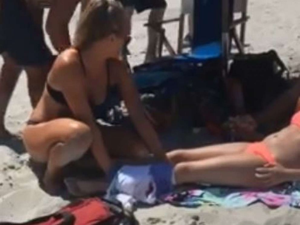 A girl was bitten on the leg in an apparent shark attack in Myrtle Beach, South Carolina, on Monday, July 2, 2018.