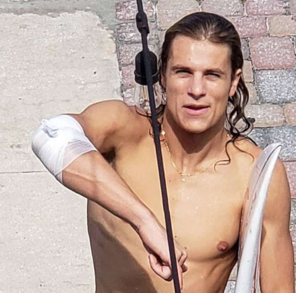 PHOTO: Frank O'Rourke, 23, shows off his bandaged right arm after he was bitten by a shark while surfing in Jacksonville Beach, Fla., on Saturday, July 27, 2019.