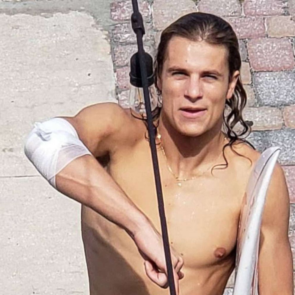 PHOTO: Frank O'Rourke, 23, shows off his bandaged right arm after he was bitten by a shark while surfing in Jacksonville Beach, Fla., on Saturday, July 27, 2019.