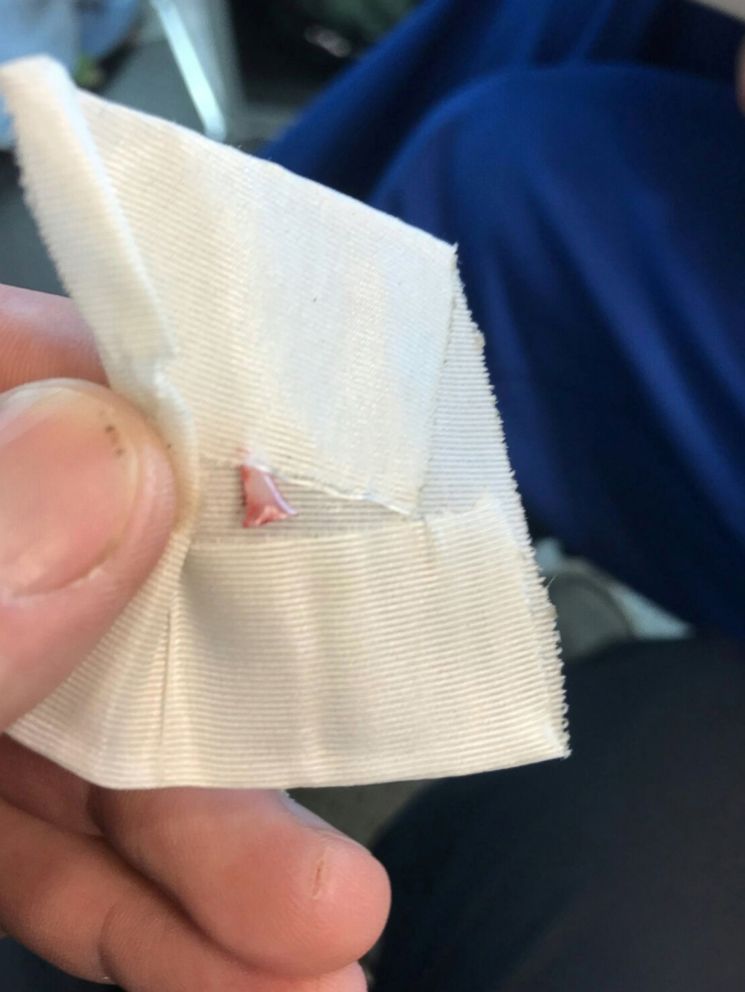 PHOTO: A shark's tooth extracted from the leg of a 13-year old boy, who was attacked at Atlantique Beach in Islip, New York, is shown in this photo provided July 18, 2018.