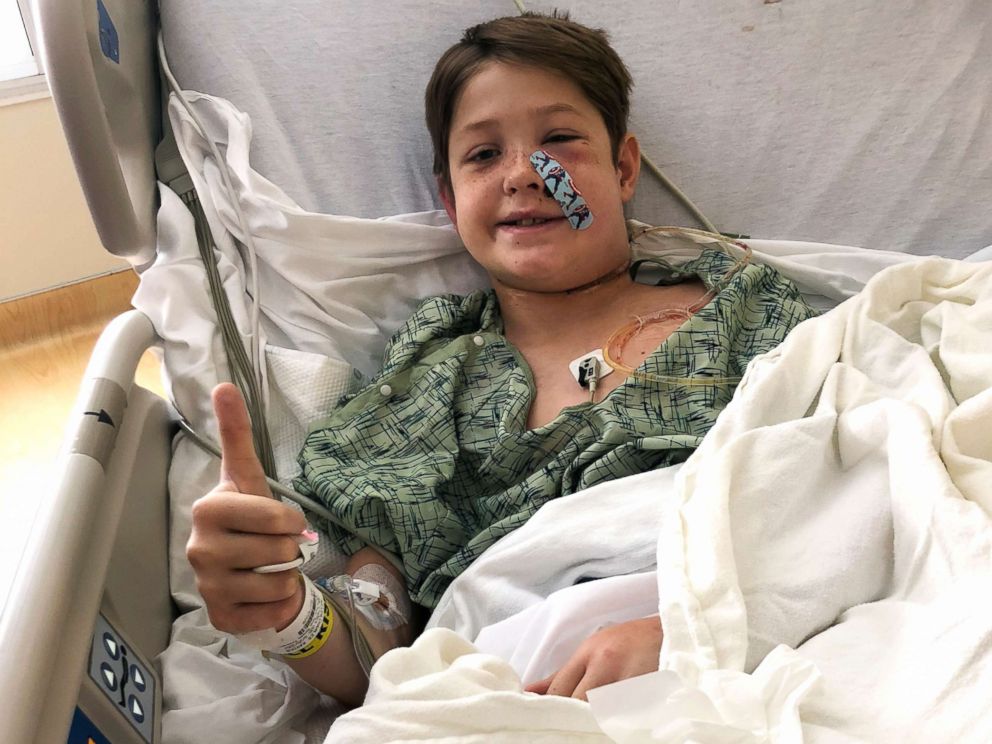 PHOTO: Xavier Cunningham, of Harrisonville, Mo., gives a thumbs up while recovering at the University of Kansas Hospital in Kansas City, Kan., after surgery to remove a meat skewer that penetrated his skull from his face to the back of his head.