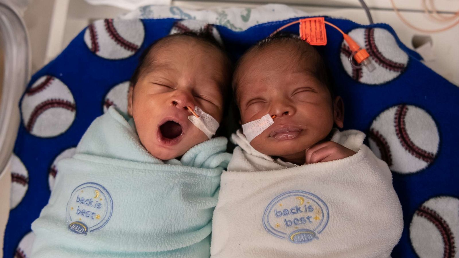 PHOTO: Saint Luke's Hospital in Kansas City, Mo., set a hospital record for caring for 12 sets of twins at the same time in November 2019.