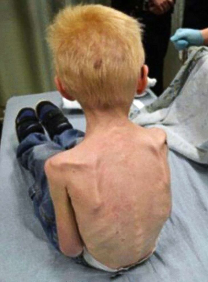 PHOTO: Police released this photo in relation to a 2015 case in which a 5-year-old was starved and kept in a closet.