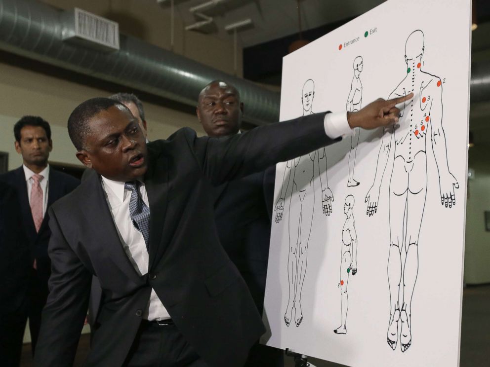 PHOTO: Pathologist, Dr. Bennet Omalu, gestures to a diagram showing the gun shot wounds he found on the body of police shooting victim Stephon Clark, during a news conference Friday, March 30, 2018, in Sacramento, Calif.