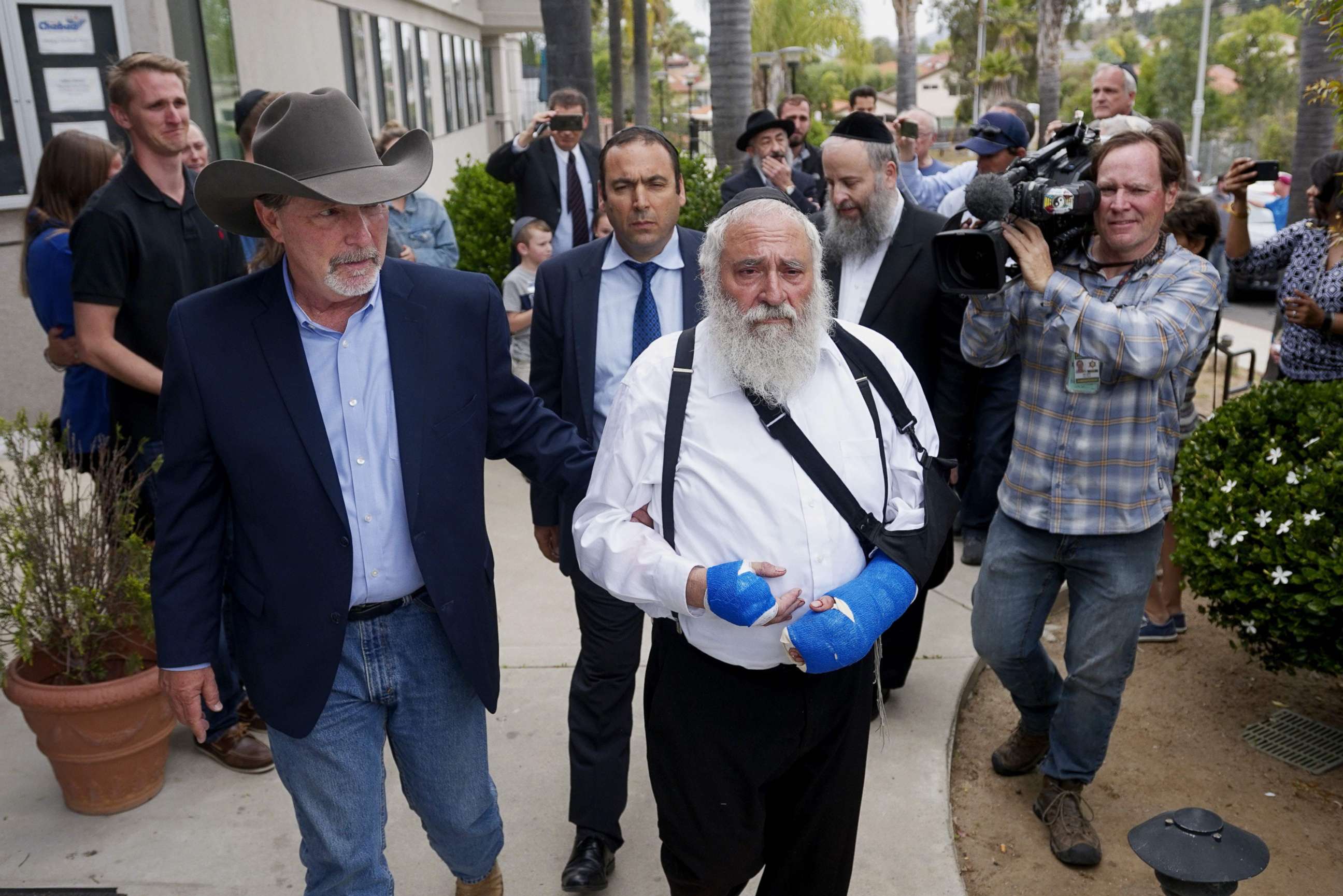 PHOTO: Executive Director Rabbi Yisroel  Goldstein, who was shot in the hands, walks towards a press conference with Poway Mayor Steve Vaus outside of the Chabad of Poway Synagogue on April 28, 2019 in Poway, Calif.