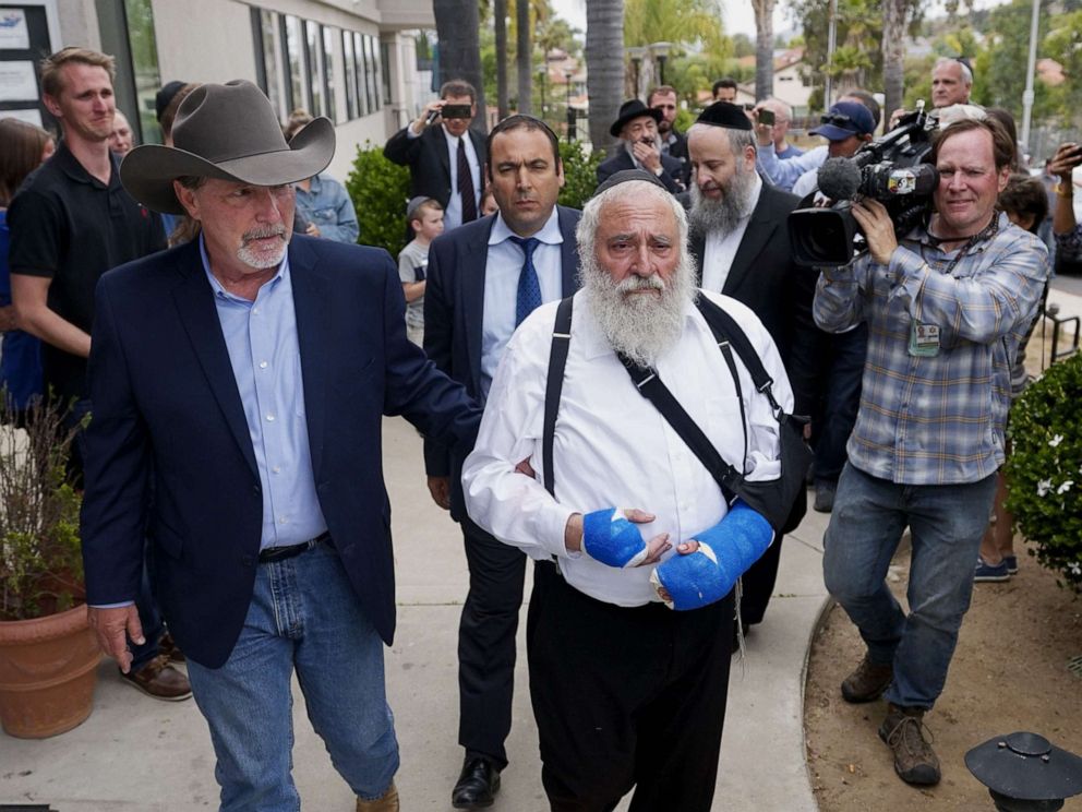 PHOTO: Executive Director Rabbi Yisroel Goldstein, who was shot in the hands, walks towards a press conference with Poway Mayor Steve Vaus outside of the Chabad of Poway Synagogue on April 28, 2019 in Poway, Calif.