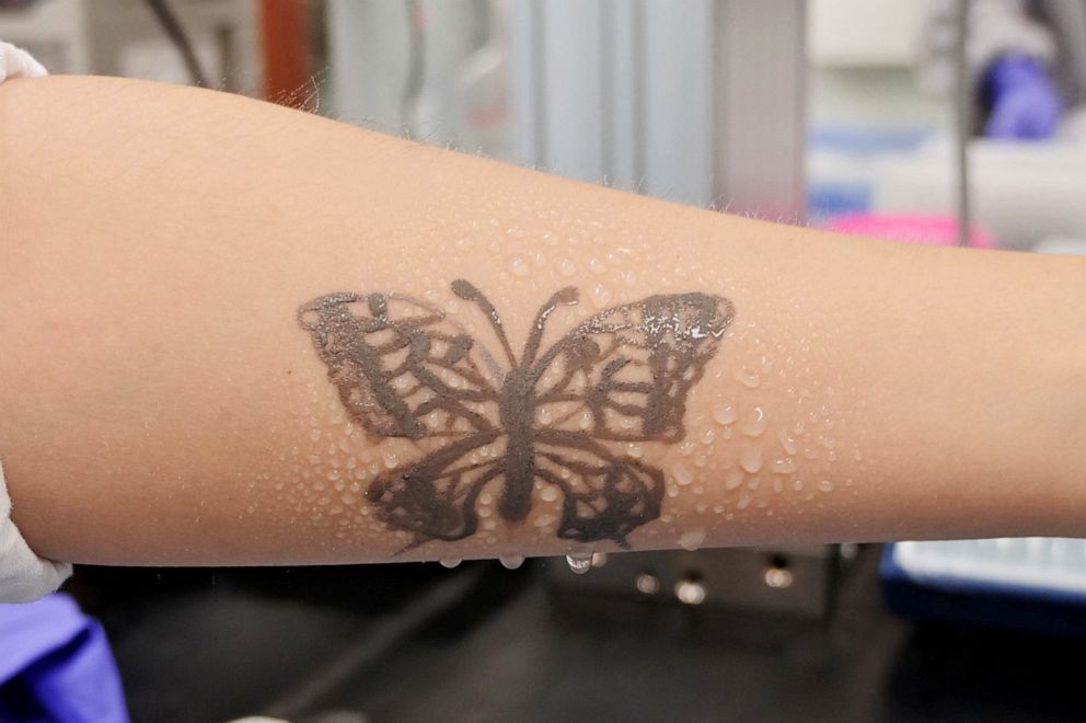 PHOTO: Water sprays on arm are seen with an electronic tattoo (e-tattoo) for the wettability test at the Korea Advanced Institute of Science and Technology (KAIST) in Daejeon, South Korea, July 26, 2022.   