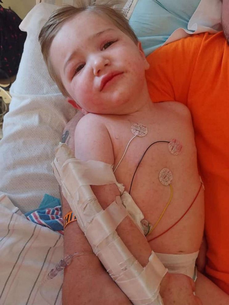 PHOTO: Kayla Oblisk's 2-year-old son Jackson was struck with Rocky Mountain Spotted Fever after he was bit by a tick in Mount Washington, Ky.