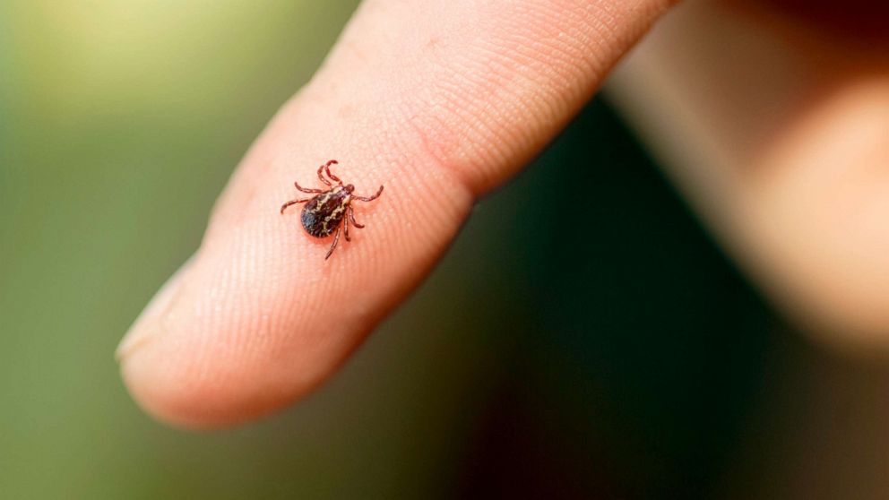 PHOTO: Stock photo of a tick on a finger.